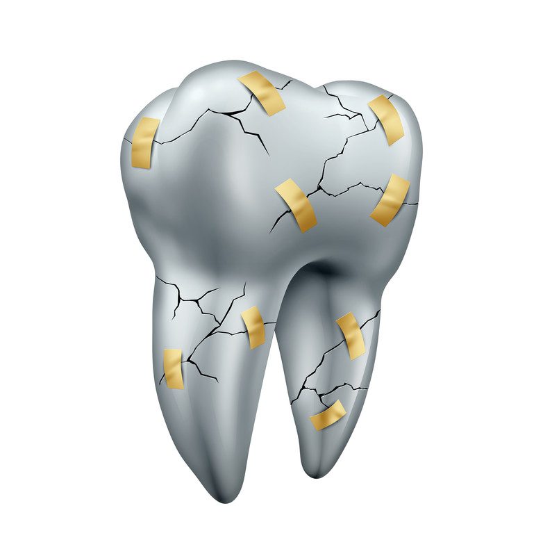 How To Know If You Have A Crack In Your Dental Filling?