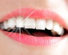 whiter teeth teeth whitening