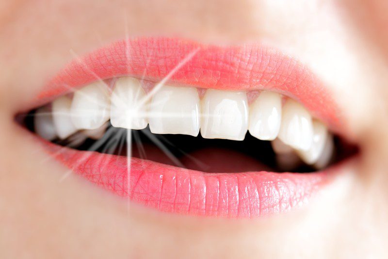 whiter teeth teeth whitening