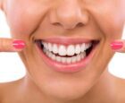 Smiling woman showing her clean white teeth